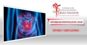 Enfermedad Diverticular del Colon