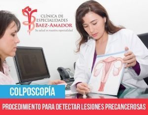 Colposcopía