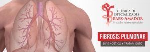 Fibrosis-Pulmonar-Clinica-Baez-Amador